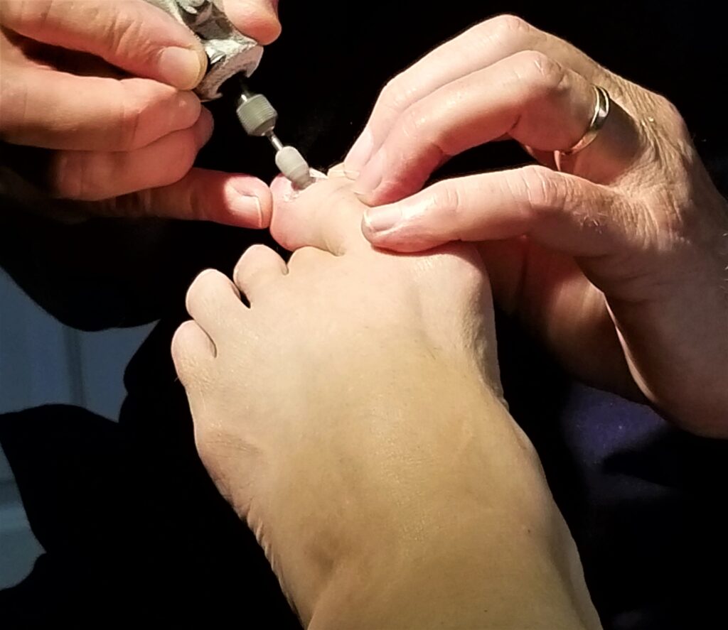 Foot and Ankle Doctor Near Toms River NJ