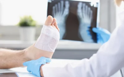 Treating Diabetic Foot Infections: When to See a Podiatrist